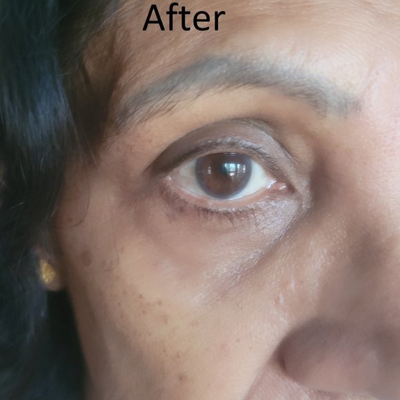 Collagen Lip and Eye Masks - Picture 5 of 6